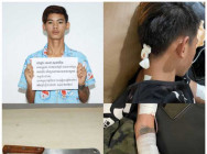 ករណីហិង្សា ស្តីបន្ទោសតិចតួច  មានជនសង្ស័យម្នាក់ កាប់ជនរងគ្រោះ បណ្តាលឱ្យរងរបួសធ្ងន់ កងរាជឣាវុធហត្ថខេត្ត បញ្ជូនជនសង្ស័យ ទៅសាលាដំបូង