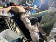 ហេតុការណ៍គួរអោយអាសូរ កសិករម្នាក់ បើកត្រាក់ទ័រភ្ជួរដីចំការ ប៉ះត្រូវមីនតោន បណ្តាលអោយផ្ទុះ ស្លាប់ពេលបញ្ជូនទៅមន្ទីរពេទ្យ